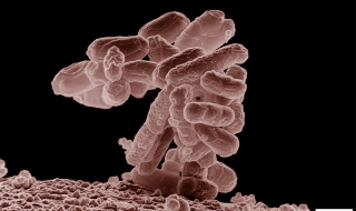 Джобен микроскоп засича опасни бактерии