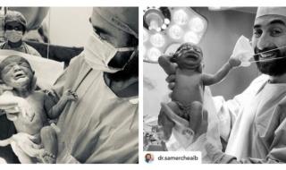 СНИМКА на новородено, дръпнало маската на лекар, стана хит в мрежата