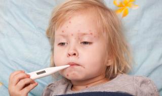 Десетки загинали от морбили в Румъния