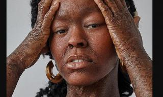 Това е жената със змийска кожа, която... (СНИМКИ)