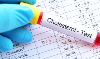 Кога се изследва холестеролът?