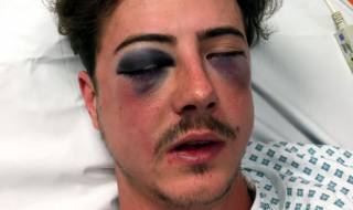 Хулиган на Тотнъм преби фен на... Тотнъм