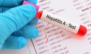 Епидемия от Хепатит А в Бяла Слатина