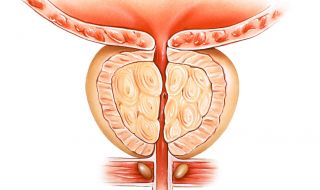 Любопитни факти за простатата