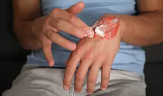 Корейски учени създадоха прах, който моментално запечатва рани