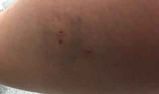 Улична котка нападна жена в София (СНИМКИ)