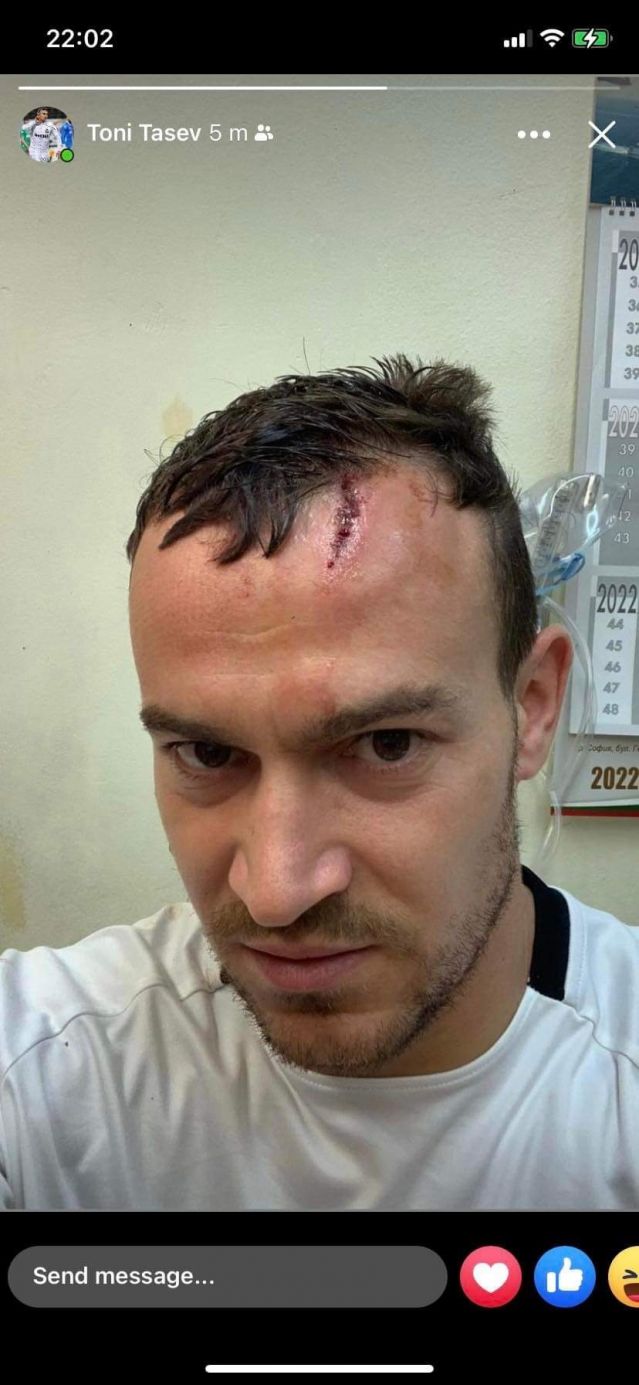 Ето какво е състоянието на Тони Тасев след влизането с бутоните на Филип Кръстев