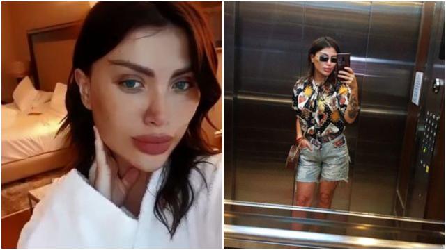 Пловдивска сексбомба стана "жената котка" след операции за 20 бона