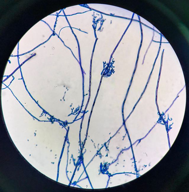  Гъби всмукват радиация на МКС 