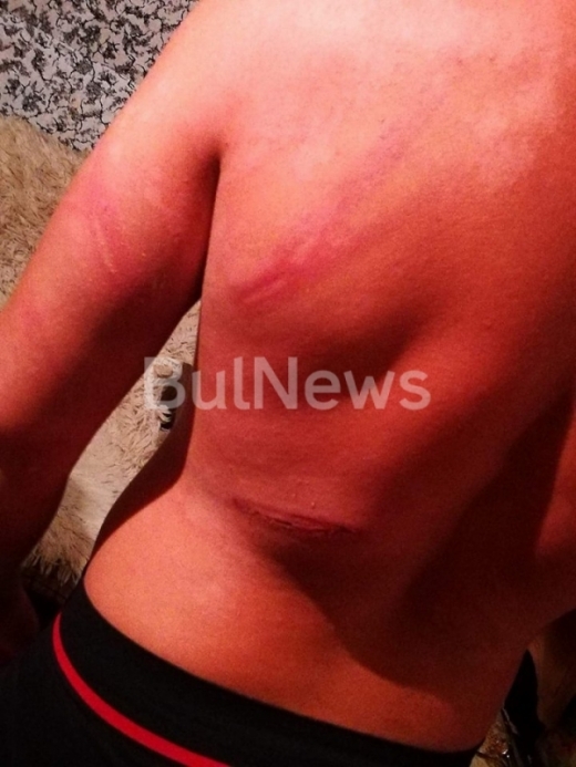 Младеж се оплака от полицейско насилие, били го до безсъзнание