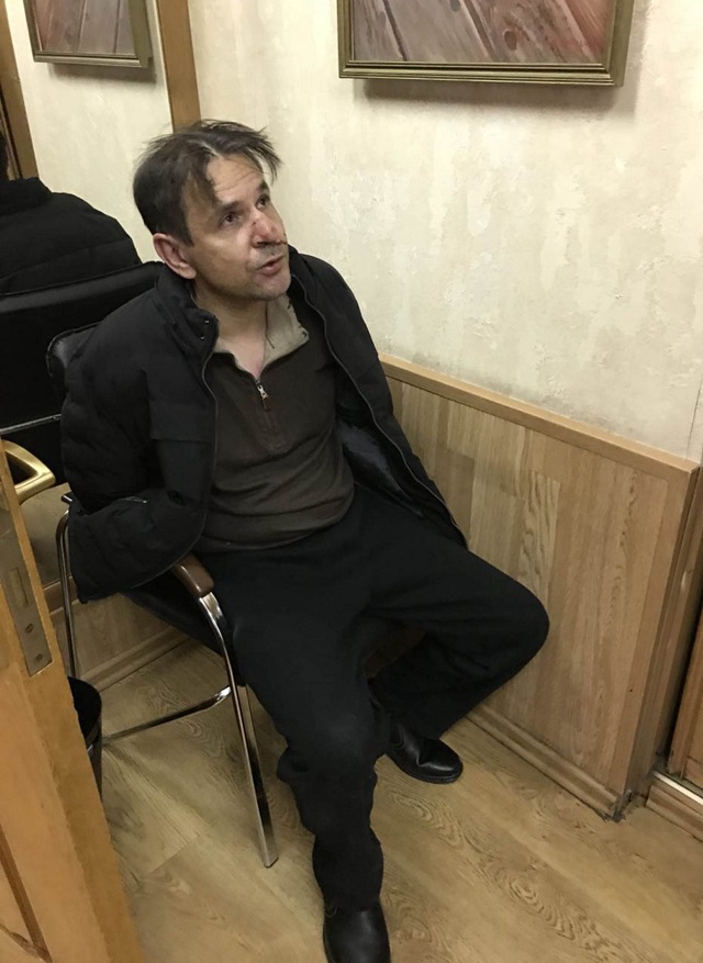 Москва е в шок след атаката срещу журналист (СНИМКИ)
