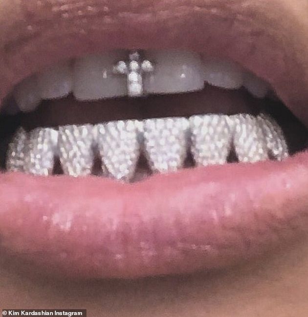 Ким Кардашиян се похвали с нови диамантени зъби