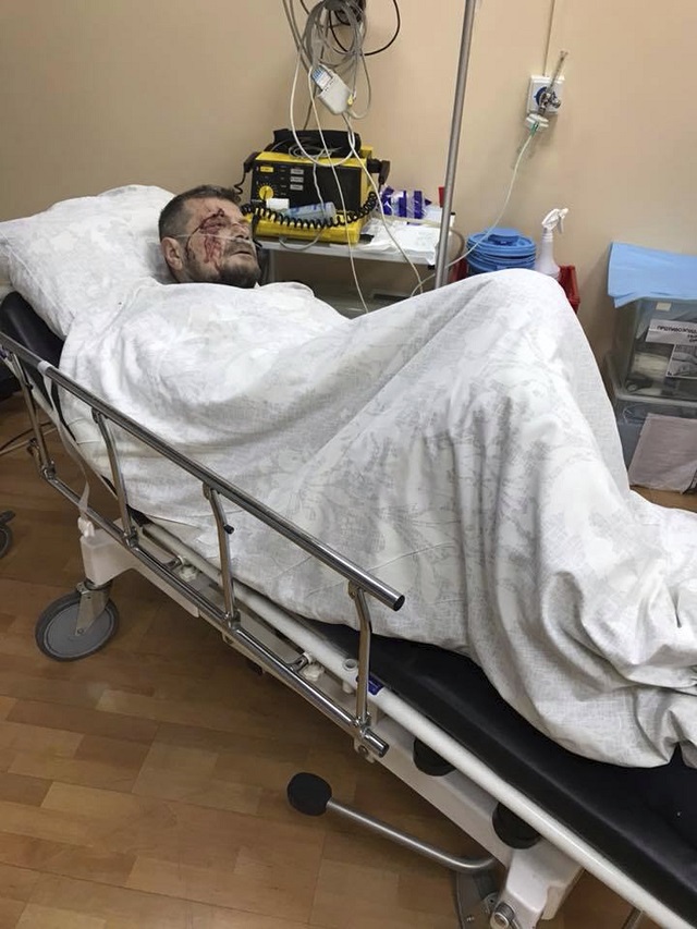 Взривеният депутат: Москва стои зад атаката (СНИМКИ)