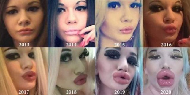  Българското Барби си постави 1200 кубика силикон и се закани да... 