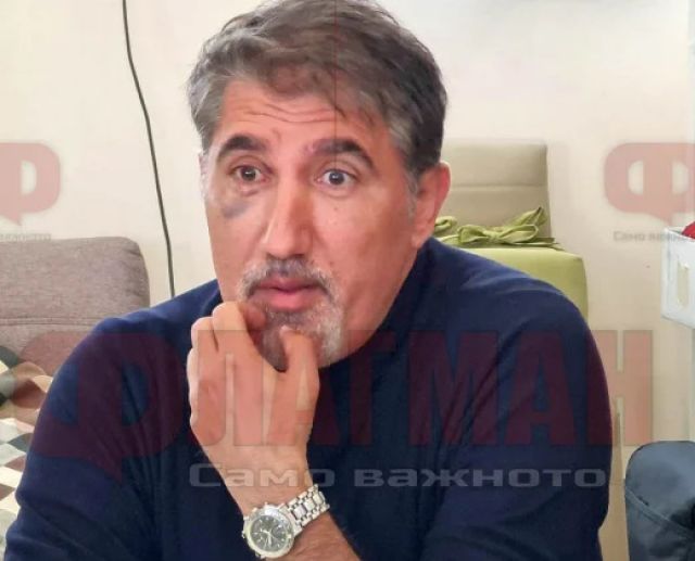 Башар Рахал се появи с насинено око в Бургас - 2