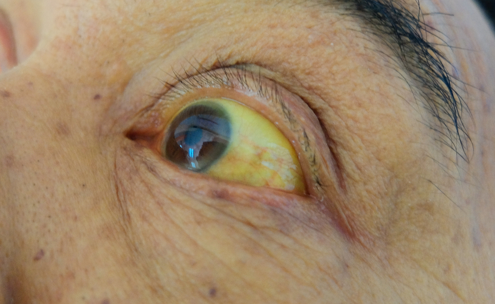 Цветът на очите разкрива здравословните ни проблеми (СНИМКИ)