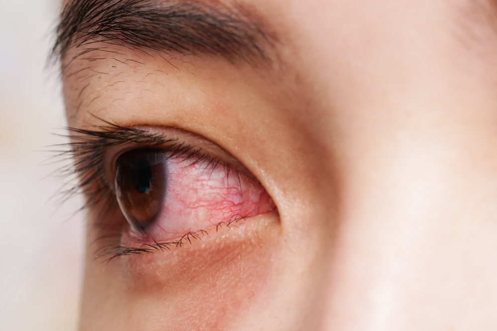 Цветът на очите разкрива здравословните ни проблеми (СНИМКИ)