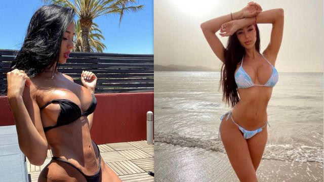  Футболна половинка се появи преди пластичните интервенции 