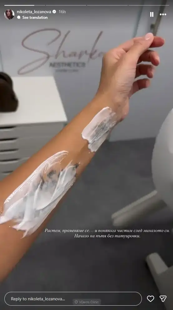 Николета Лозанова реши да премахне татуировките си