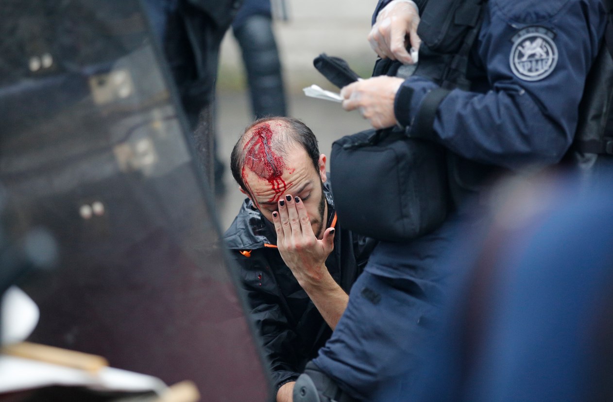 Граната откъсна ръката на протестиращ във Франция