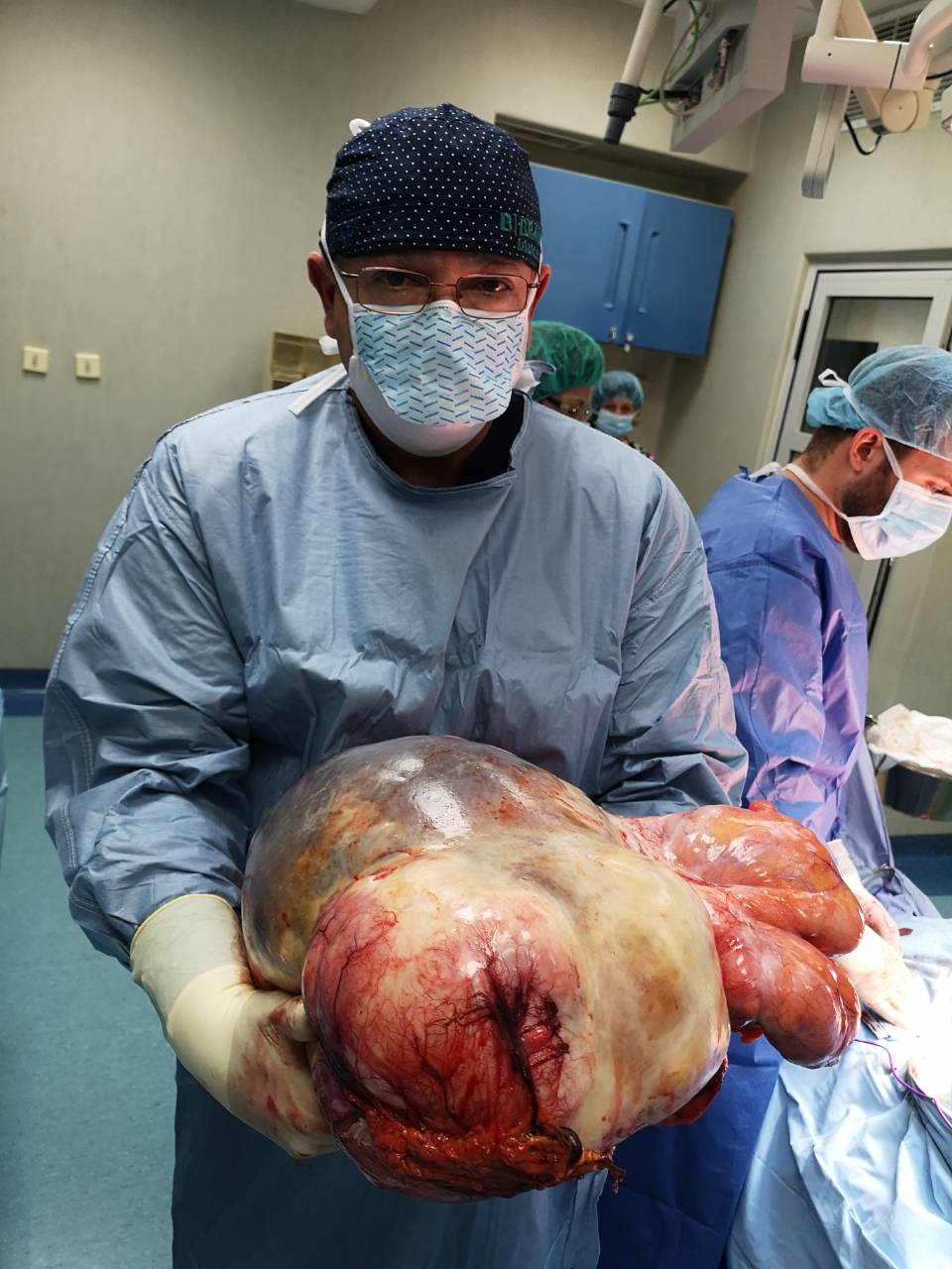Във ВМА извадиха 18-килограмов тумор (СНИМКИ)