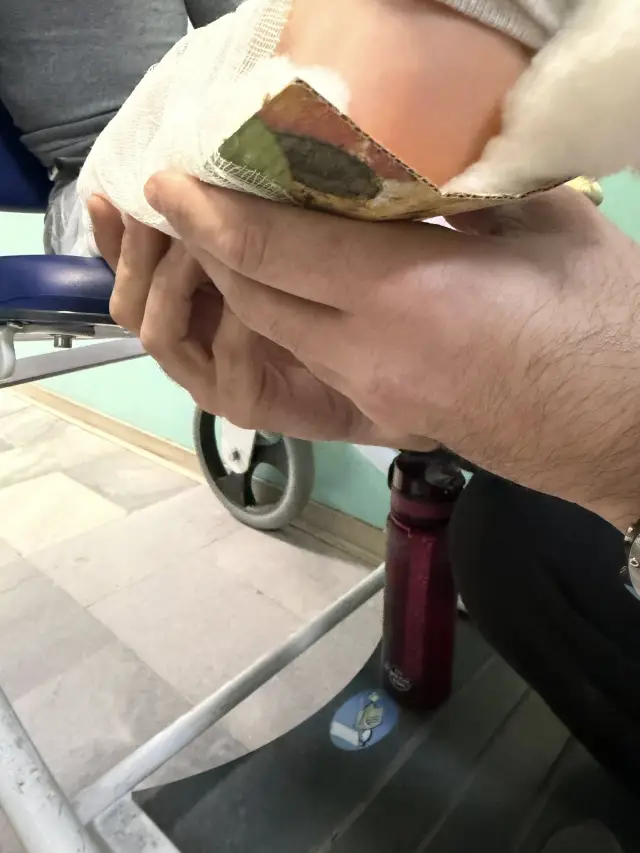 Шинираха с картон от кутия за пица счупен крак на дете