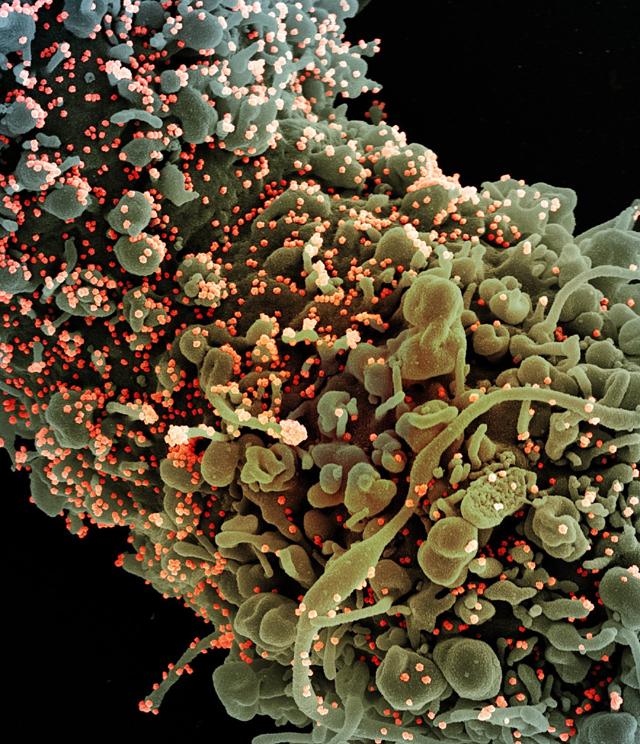 Така изглежда човешка клетка, заразена с COVID-19
