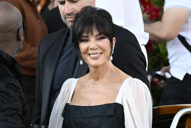 Крис Дженър дала 100 хил. долара за фейслифт, който не издържал