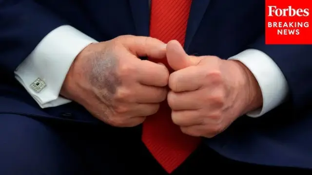 Тръмп се появи на коледно събитие с посиняла китка 