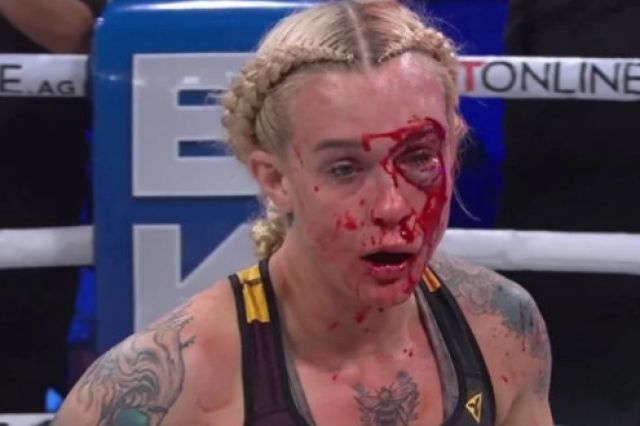  Брутално нападателен мач приключи с към 500 удара (ВИДЕО) 