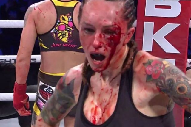  Брутално нападателен мач приключи с към 500 удара (ВИДЕО) 