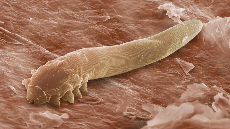 Как да разберем, че имаме паразити в тялото?