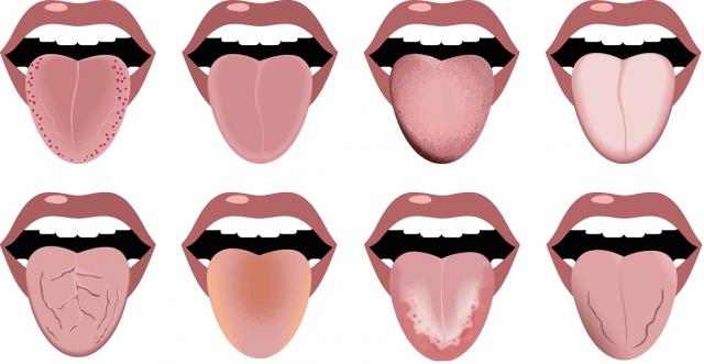 Ако видите това по езика си...