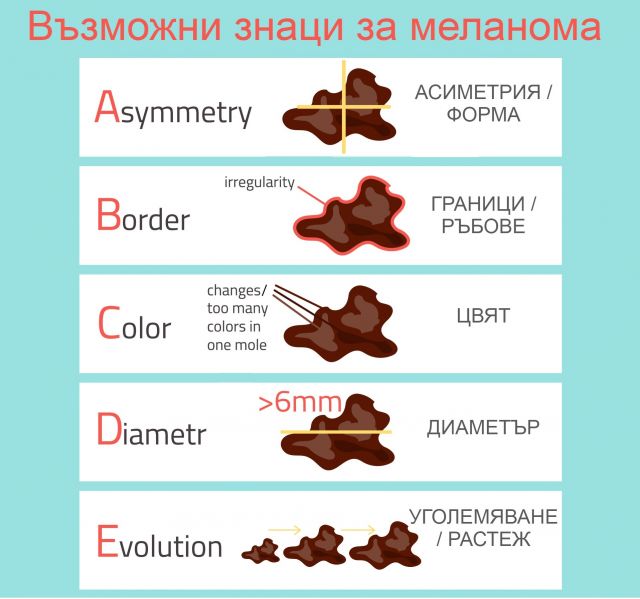 5 признака, че лекар спешно  трябва да види бенките ви 