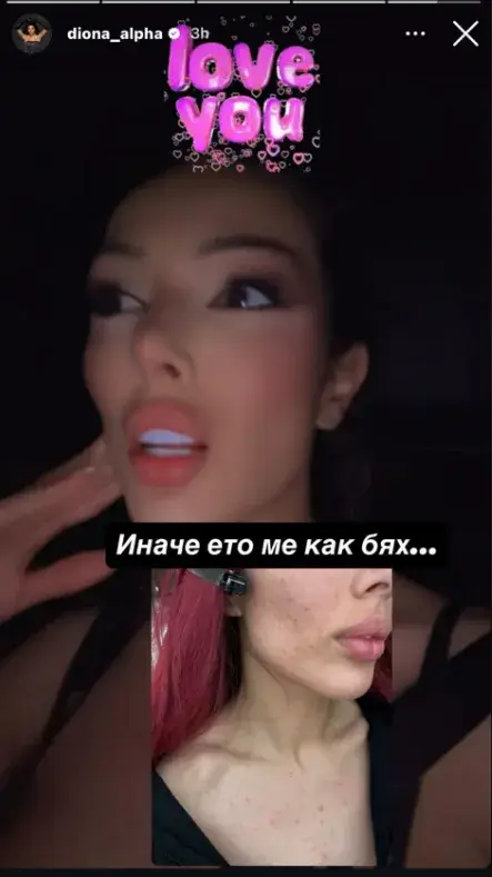 Диона се бори със сериозен здравословен проблем (СНИМКА)