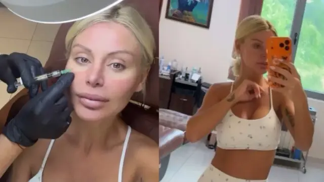 Светлана Василева изпробва хитова подмладяваща процедура с ДНК от сьомга (СНИМКИ)