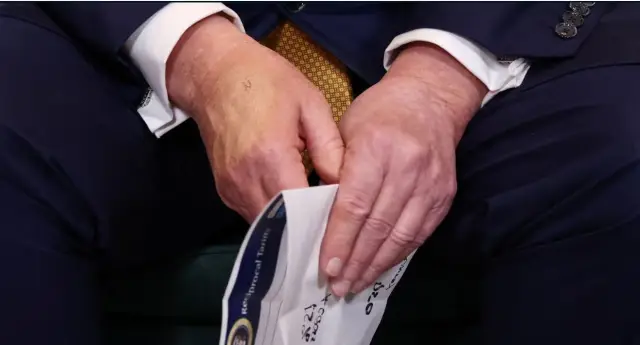  Доналд Тръмп с гримирани ръце в Шотландия, крие синини (СНИМКА) 