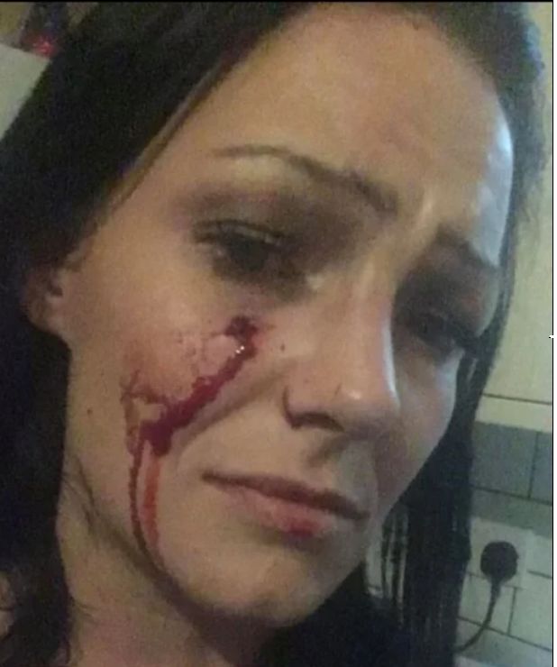  Жена обезобрази с отвертка модел 