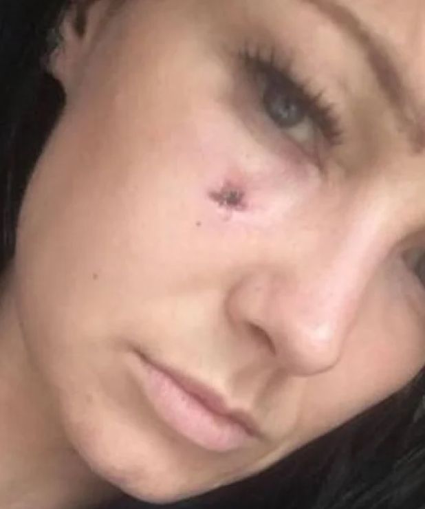  Жена обезобрази с отвертка модел 