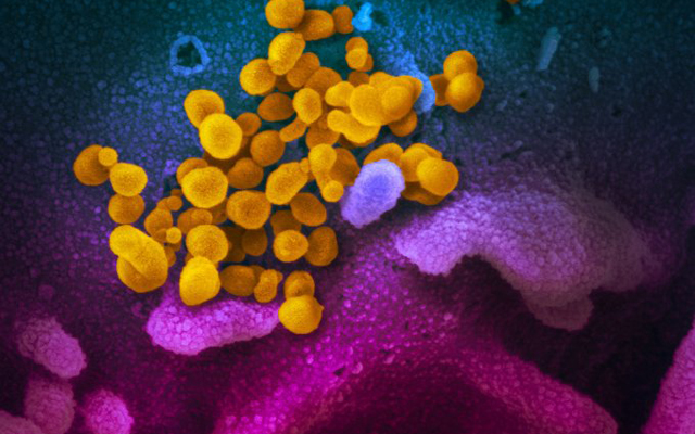 Американците публикуваха снимки на китайския коронавирус