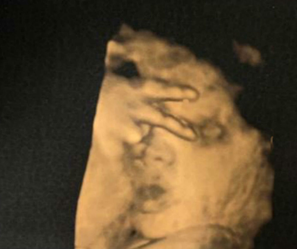 Лекари видяха нещо смайващо при преглед на бременна с видеозон (СНИМКА)
