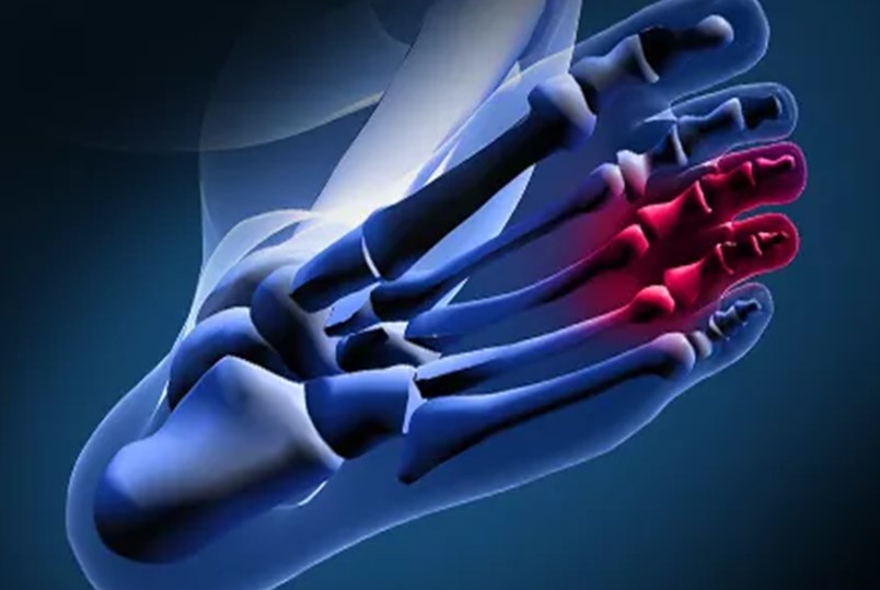 5 възможни причини за болки в стъпалата