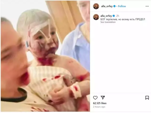 Алла Пугачова се възмути от удара по детската болница в Киев СНИМКА - 2
