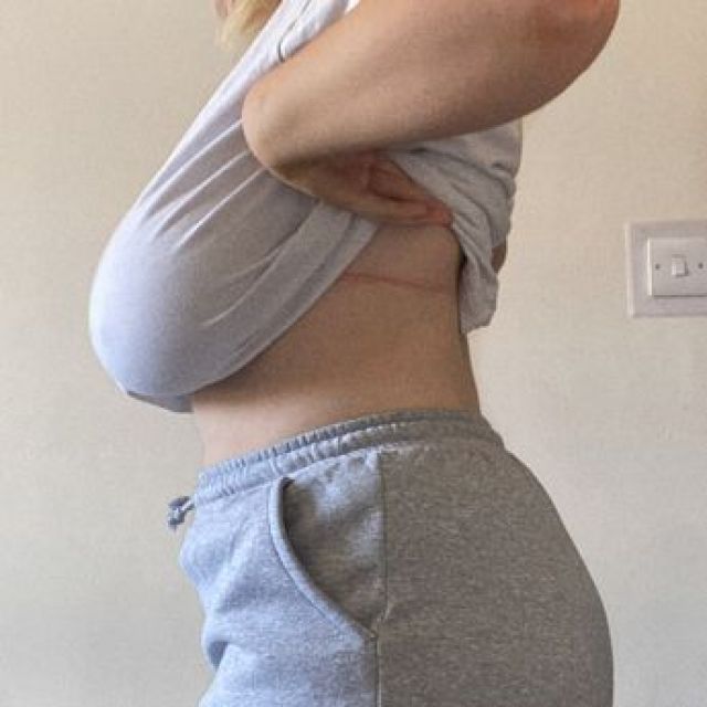  Млада жена показа за ужасяващ случай с огромните ѝ гърди 