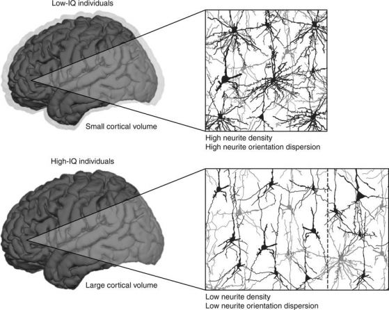 По-умните хора имат по-малко невронни връзки в мозъка