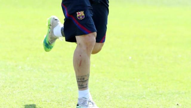 Ето как изглежда кракът на Меси след грубото влизане на Диего Карлос