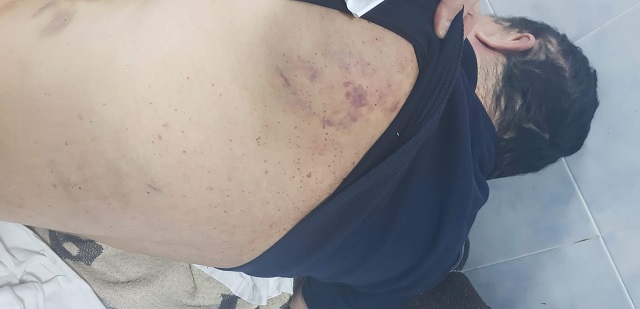 Само във ФАКТИ: Полицейско насилие в Бургас (СНИМКИ)