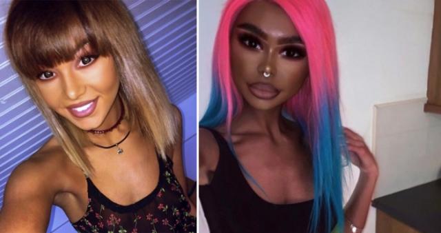  Защо кожата на Хана сменя цвета си непрекъснато? (СНИМКИ) 