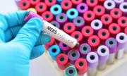 Унгария проучва ефикасността на разработваните в Русия и Китай ваксини за коронавируса
