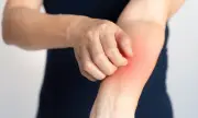 Жена сподели ранни симптоми на рак, които е пренебрегнала